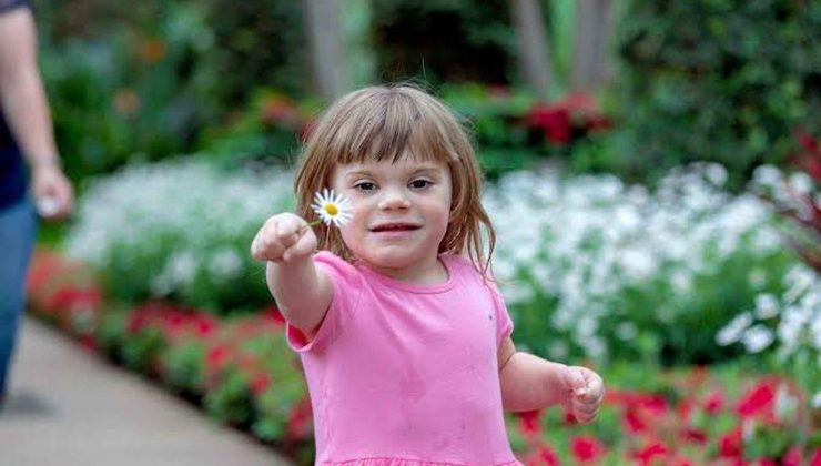 Turner Sendromu Nedir? zxzczxc