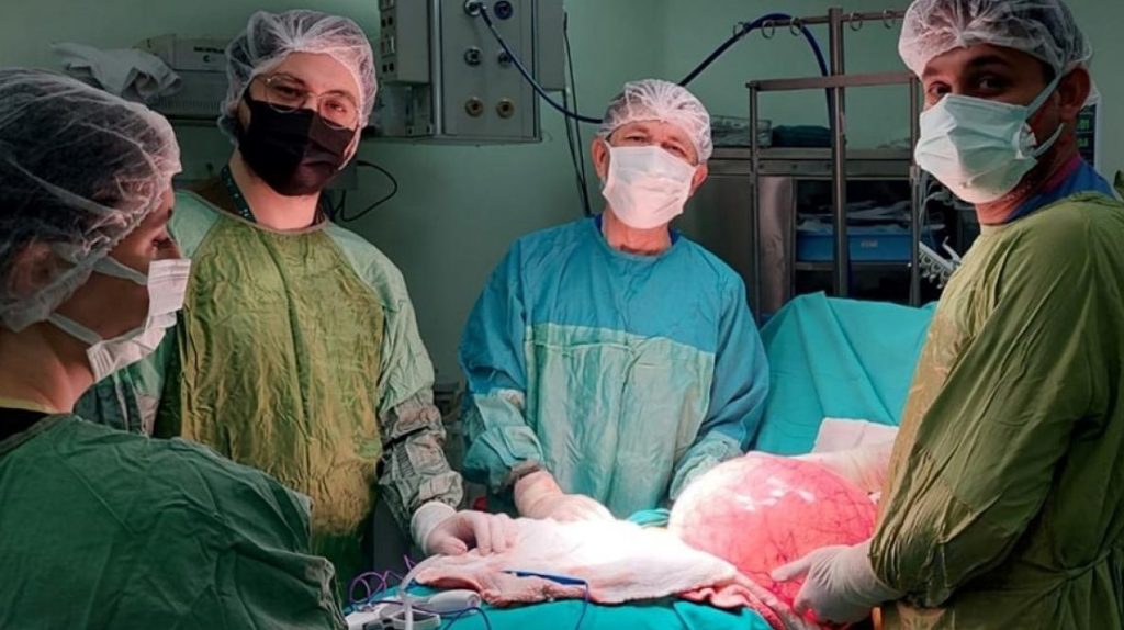 30 santimetrelik tumor cikartildi8230 ksbu8217de basarili operasyon