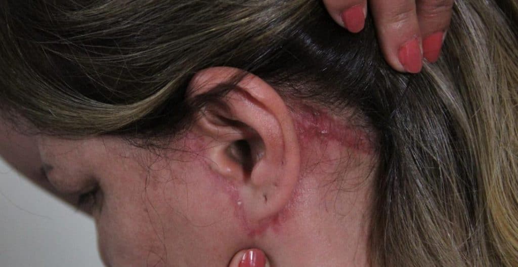 75 bin lira kredi cektigi estetik ameliyati sonrasinda doktordan sikayetci oldu