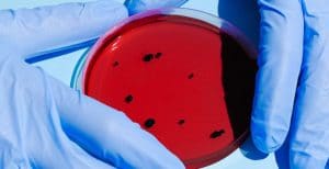 Tarihte ilk olarak 1958’de maymunda bulunan virüs, insanlar arasında ilk