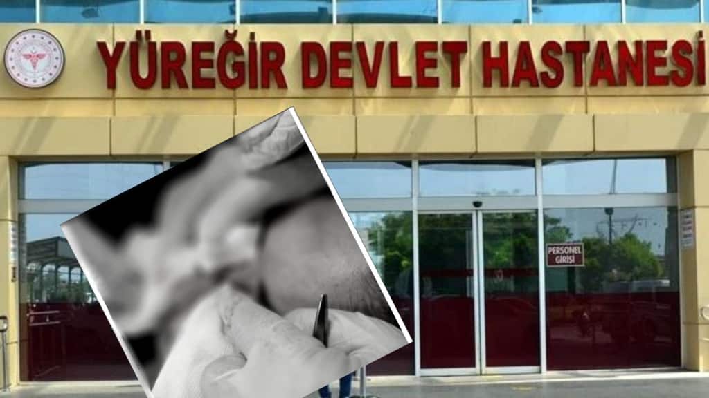 adana yuregir devlet hastanesi acil servisinde dehset hemsire darbedildi