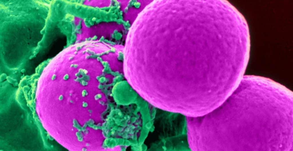 Deniz ve Havuz Ortamları İdrar Yolları Enfeksiyonu Riski Barındırıyor deniz ve havuz ortamlari idrar yollari enfeksiyonu riski barindiriyor