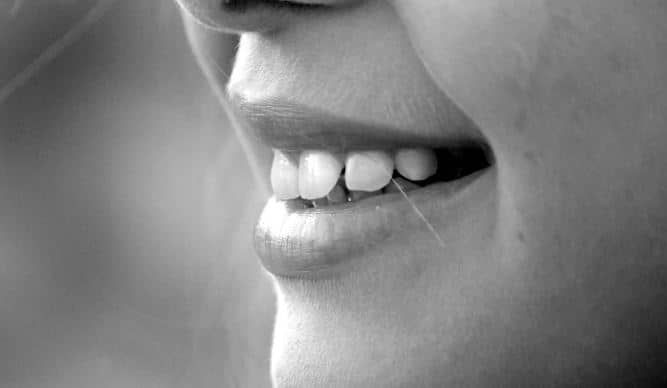 dişler nasıl beyazlatılır?