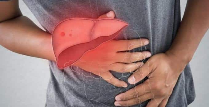 Ciltteki değişiklikler karaciğer hastalıklarının belirtisi olabilir. Ciltte görülen sivilce ve karaciğer