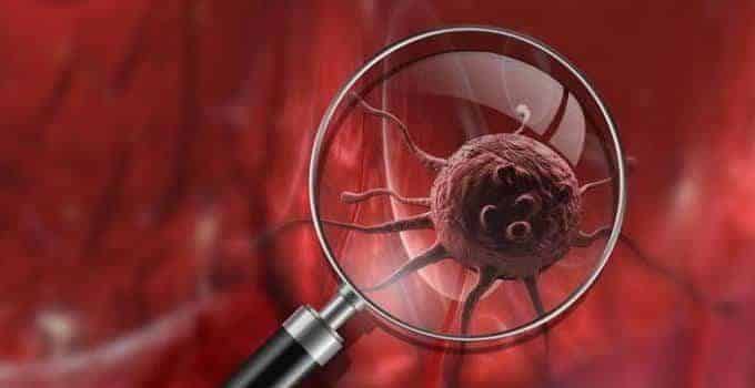 Teranostik sözcüğü; İngilizce “diagnosis” (tanı) ve “therapy” (tedavi) kelimelerinden türetilmiştir.