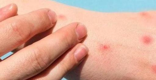 Kamerun Halk Sağlık Bakanlığı paylaştığı raporda, başkent Yaounde’de bulunan Pasteur