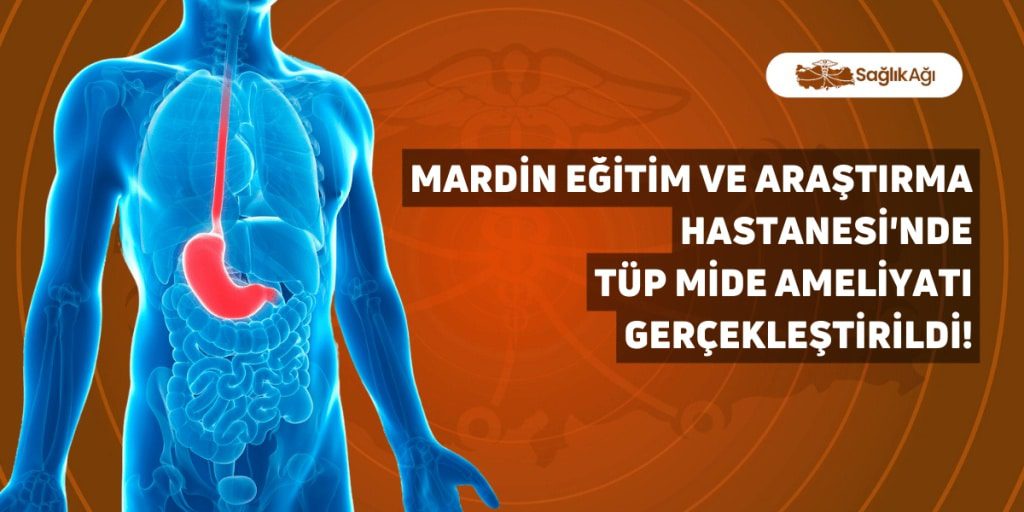 Mardin Eğitim ve Araştırma Hastanesi'nde Tüp Mide Ameliyatı Gerçekleştirildi