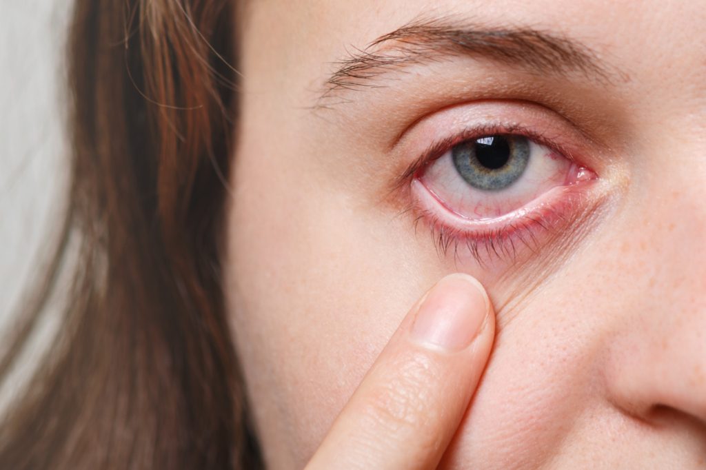 en yaygın göz hastalıkları ve tedavi yöntemleri
