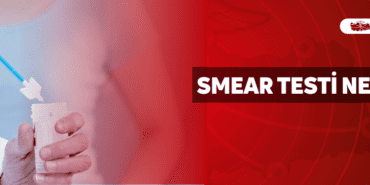 smear