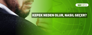 Kepek Neden Olur, Nasıl Geçer?