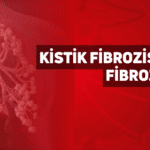 kistik-fibrozis