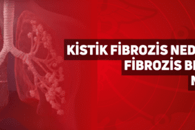 kistik-fibrozis