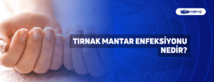 Tırnak Mantar Enfeksiyonu Nedir?