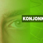 konjonktivit
