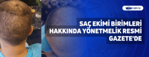 Saç Ekimi Birimleri Hakkında Yönetmelik Resmi Gazete’de