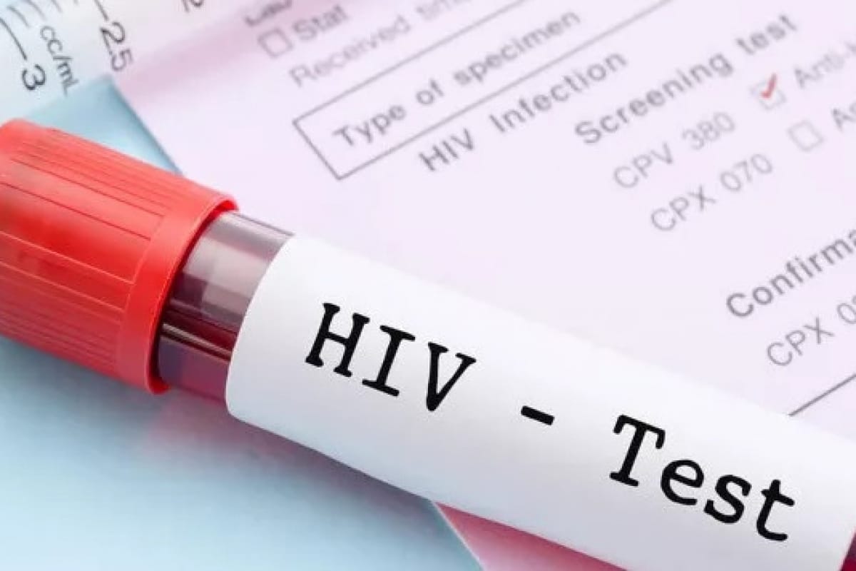 türkiye'de hiv i̇le yaşayan 32 bin 376 kişi tespit edildi