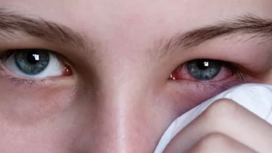 "kırmızı göz" hastalığına yakalananların sayısı 86 bini geçti!