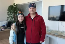 rus hekimler ‘kesilmeli’ dedi: çocuğun parmağını türk doktor kurtardı