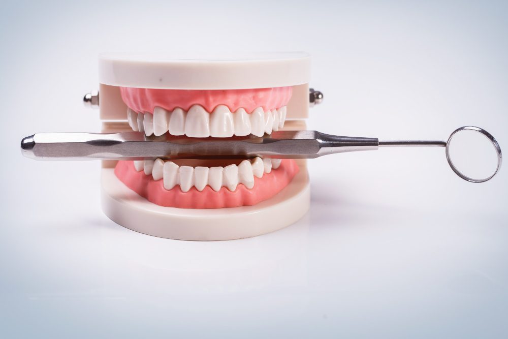 diş eti çekilmesi: nedenleri, belirtileri ve önlemler