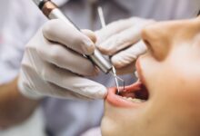 diş hekimi i̇le hasta 150 fidan bağışı şartıyla uzlaştı