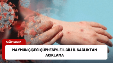 maymun çiçeği şüphesiyle i̇lgili i̇l sağlıktan açıklama