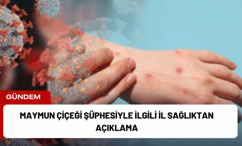 maymun çiçeği şüphesiyle i̇lgili i̇l sağlıktan açıklama