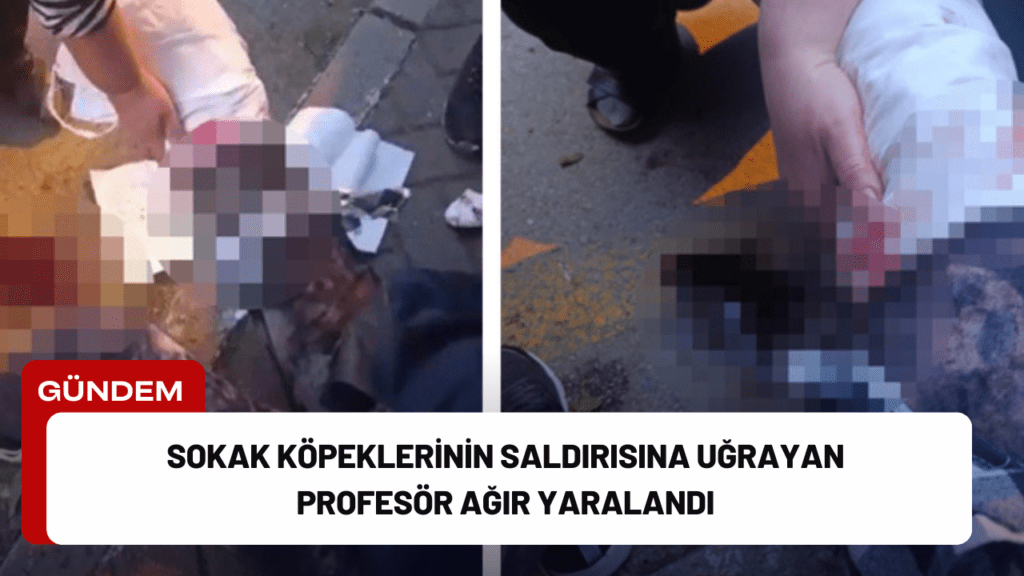 Sokak Köpeklerinin Saldırısına Uğrayan Profesör Ağır Yaralandı