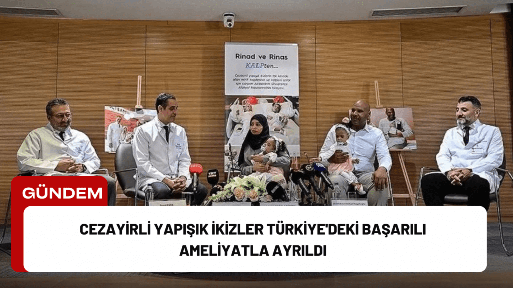 Cezayirli Yapışık İkizler Türkiye'deki Başarılı Ameliyatla Ayrıldı