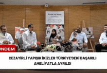 cezayirli yapışık i̇kizler türkiye'deki başarılı ameliyatla ayrıldı