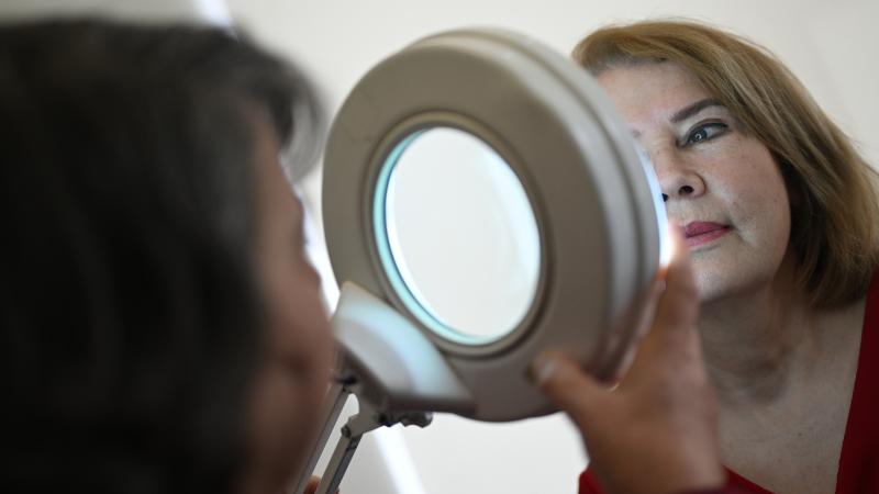 Türk Dermatoloji Derneğince (TDD), cilt kanserinin erken dönem tespit edilebilmesi