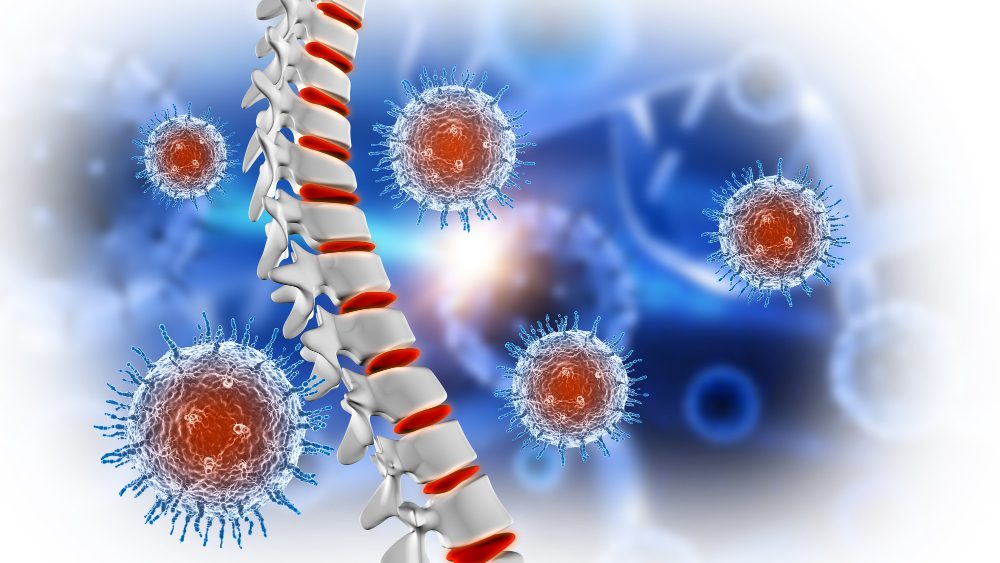 Osteoporoz: Tanı, Tedavi ve Uzun Dönem Yönetim Rehberi