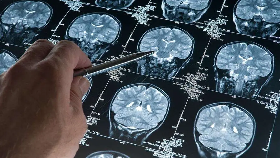 Alzheimer hastalığının nedenlerini ve etkili tedavi yollarını bulmak için onlarca