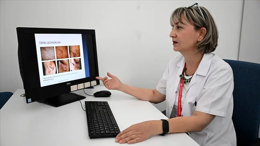 Halk arasında “köpek memesi hastalığı” olarak bilinen Hidradenitis Süpürativa (HS),