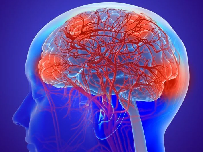 Çinli araştırmacılar, Parkinson hastalığının henüz klinik semptomlar ortaya çıkmadan önce