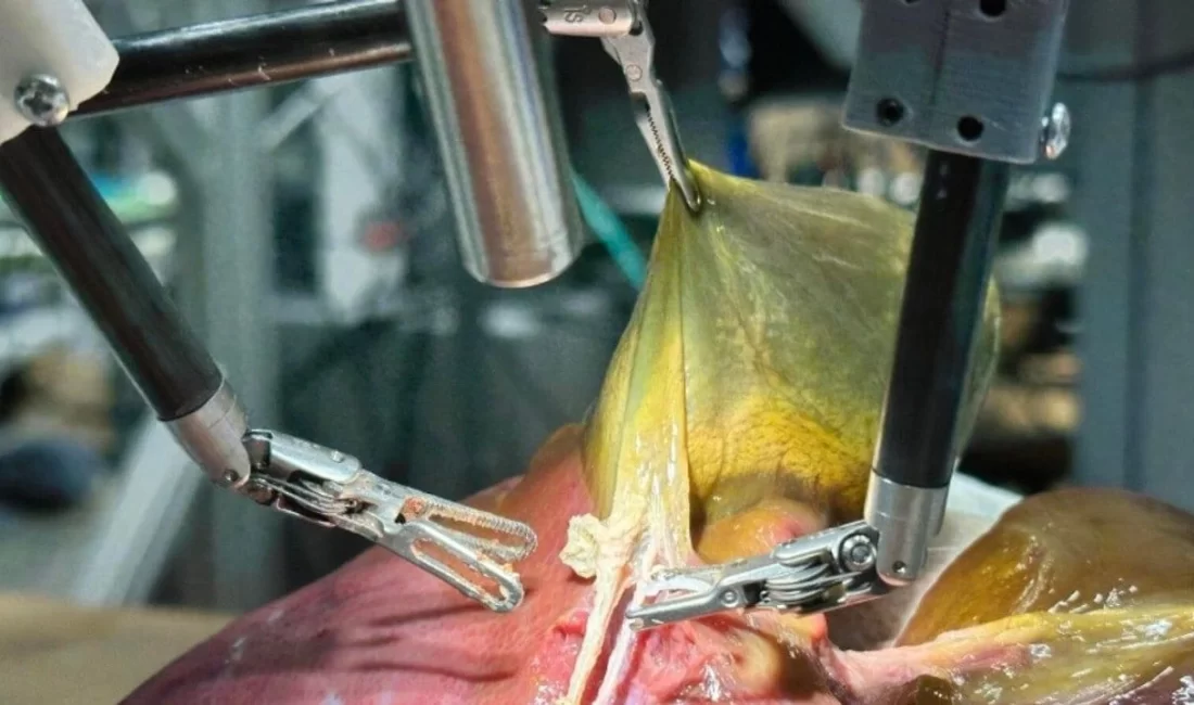 Johns Hopkins Üniversitesi’nden bilim insanları, yapay zeka ile donatılmış tam