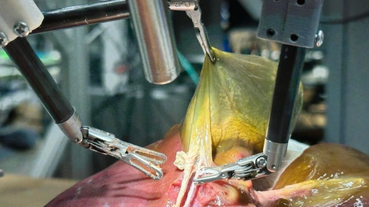 Yapay Zeka Destekli Robot, İlk Kez Bağımsız Ameliyat Gerçekleştirdi Yapay Zeka Destekli Robot, İlk Kez Bağımsız Ameliyat Gerçekleştirdi