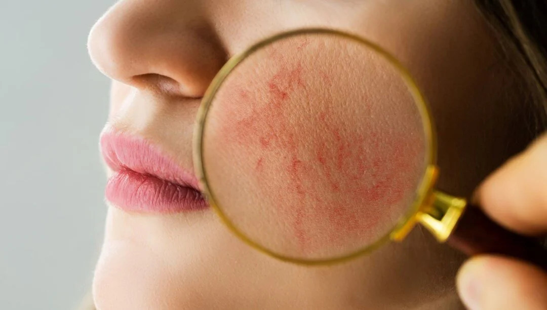 Türk Dermatoloji Derneği Başkanı Prof. Dr. Ertan Yılmaz, halk arasında