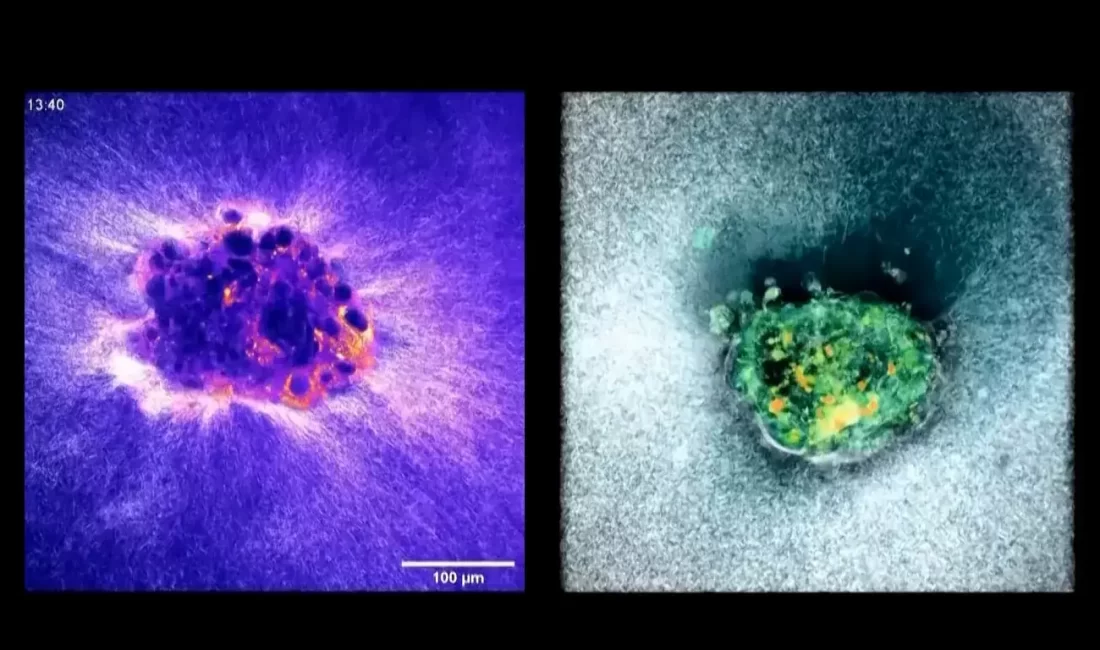 Bilim dünyası, düşüklerin en önemli nedenlerinden birine ışık tutacak çığır