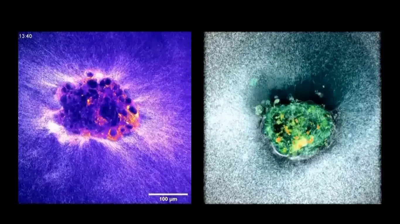 Düşüklerin En Büyük Nedenine Çözüm: Yapay Rahimle Tarihi Başarı Düşüklerin En Büyük Nedenine Çözüm: Yapay Rahimle Tarihi Başarı