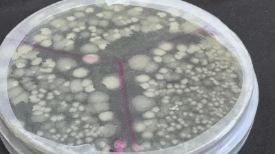 ABD’li bilim insanları, insanlarda nadir görülen bir genetik mutasyondan yola