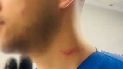 Kocaeli Üniversitesi Tıp Fakültesi Hastanesinde, salı günü öğle saatlerinde bir