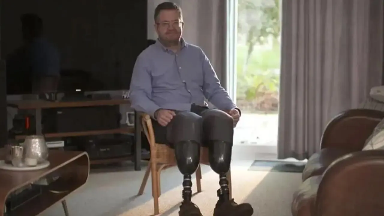 Kendi Bacaklarını Kestiren İngiliz Cerrah Dolandırıcılıktan Hapse Atıldı Kendi Bacaklarını Kestiren İngiliz Cerrah Dolandırıcılıktan Hapse Atıldı