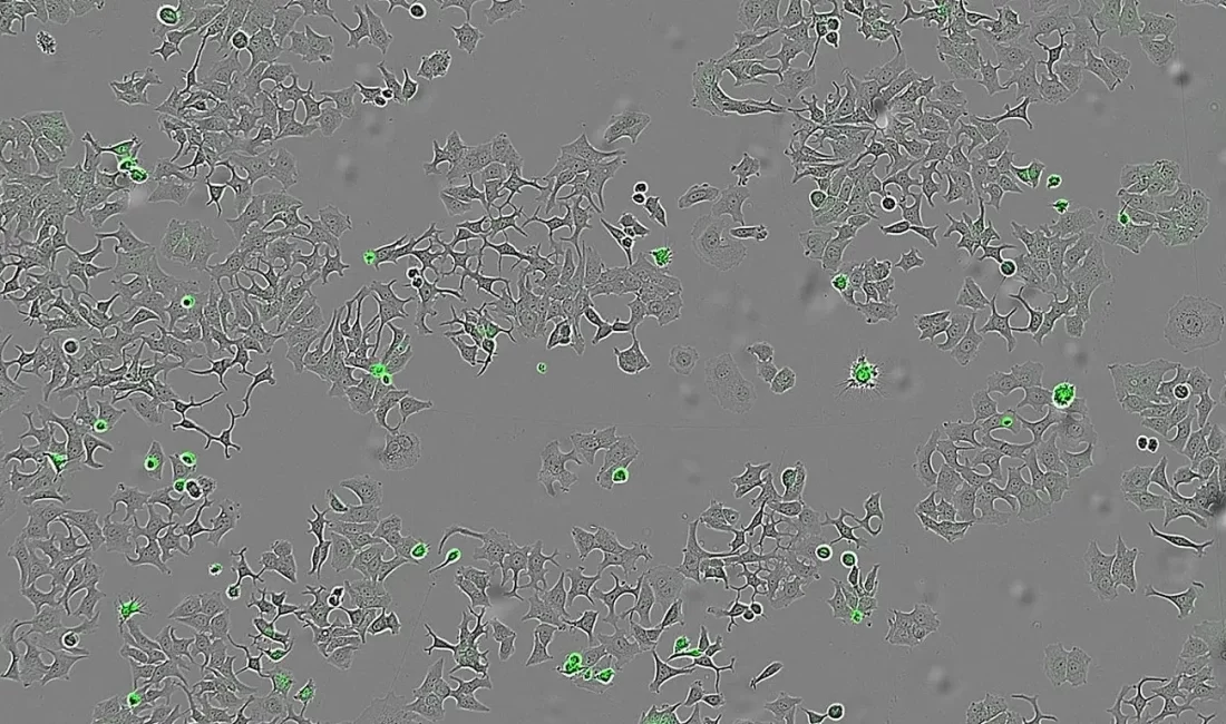 İspanyol bilim insanları, Vibrio cholerae bakterisinin salgıladığı HapA proteininin tümör