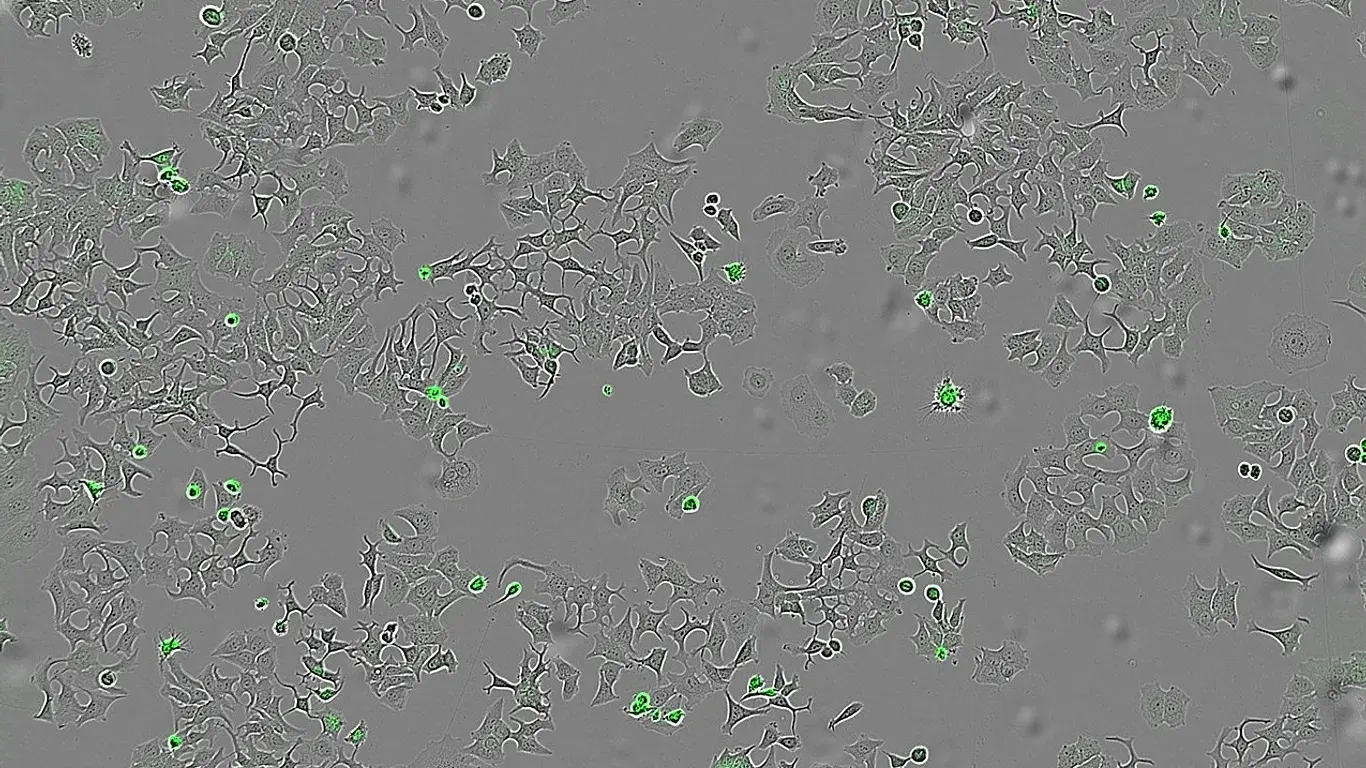 Umut Veren Keşif: Bakteri Proteini Kanser Hücrelerini Yok Etti