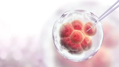 Kayseri – Erciyes Üniversitesi Tıp Fakültesi Çocuk Nörolojisi Bilim Dalı