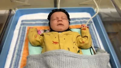 İngiltere’de araştırmacılar, doğum sırasında ya da hemen sonrasında ortaya çıkan