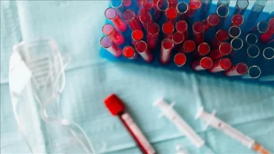 Kanser taramalarında ezber bozacak bir yöntem geliştirilirken, sonuçlar bilim dünyasında