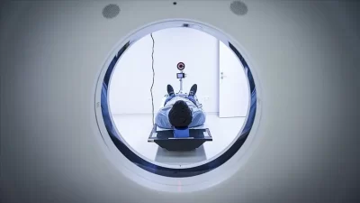 İngiltere, prostat kanseri teşhisini hızlandırmak için devreye aldığı yeni yapay