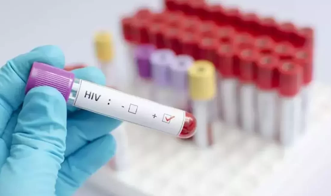 Türkiye’de HIV vakaları hızla artarken uzmanlar, toplumdaki önyargı ve damgalanma