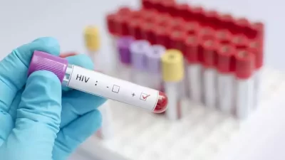 Türkiye’de HIV vakaları hızla artarken uzmanlar, toplumdaki önyargı ve damgalanma